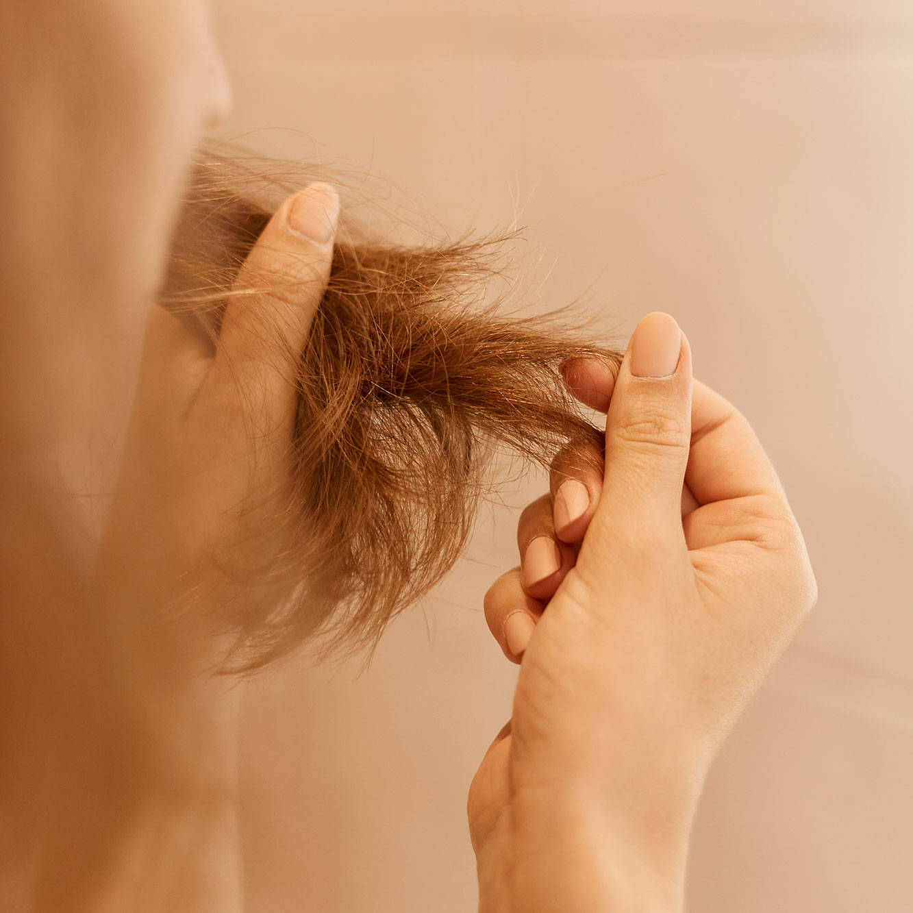 Autoimmune and Scarring Hair Loss