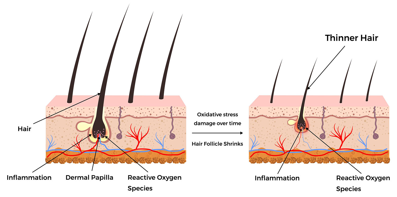 Web Diagram: The Root of Hair Loss